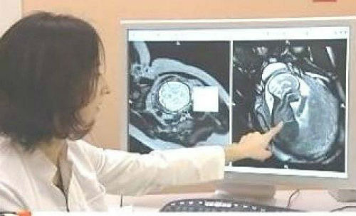 МР-холангиография при беременности - особенности